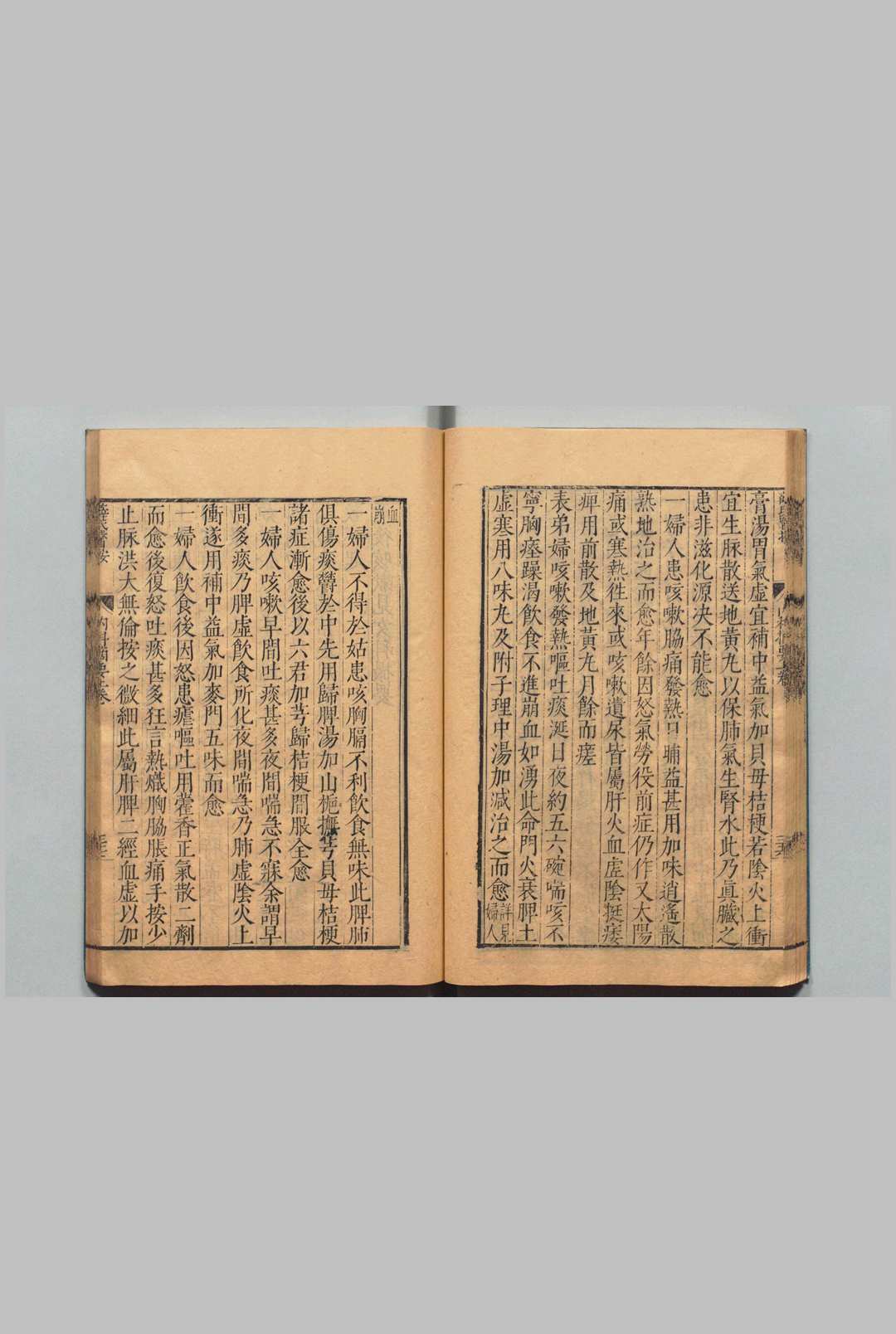 中医古籍《薛氏医按》 二十四种本 薛己 吴琯 明万历间 (图6) 中医古籍《薛氏医按》 二十四种本 薛己 吴琯 明万历间 (图6)