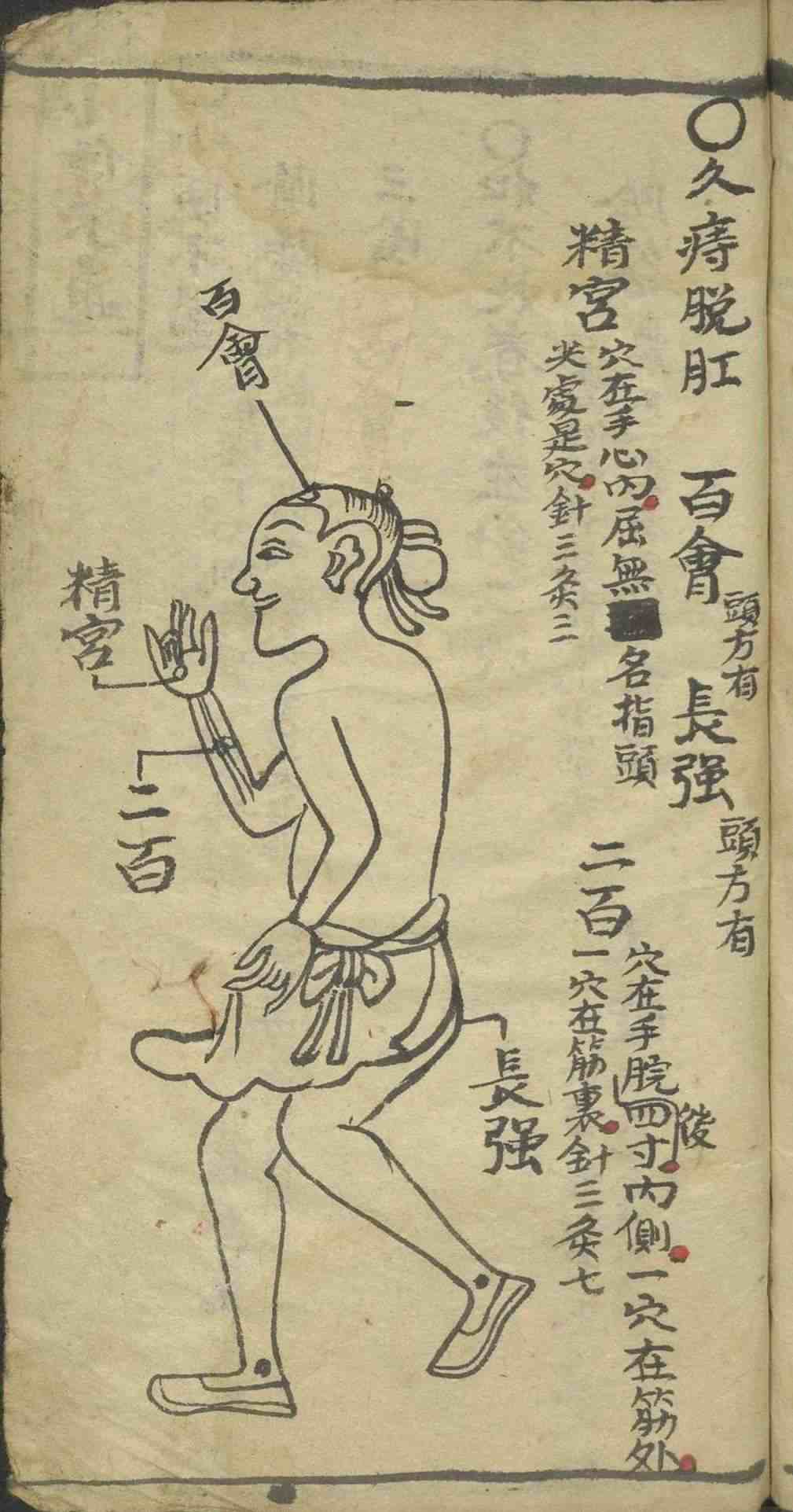 中医古籍《​绘图手抄医书》(图11)