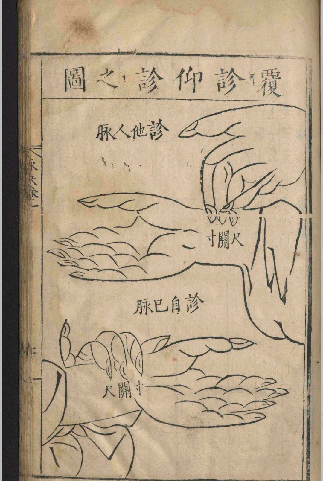 中医古籍《​图注王叔和脉诀》王叔和 张世贤(图16)