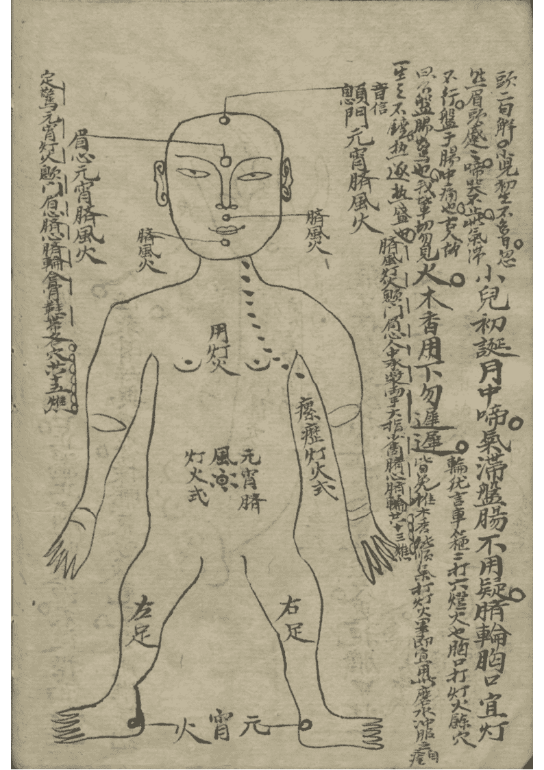 中医推拿古籍《小儿推拿书》(图12)