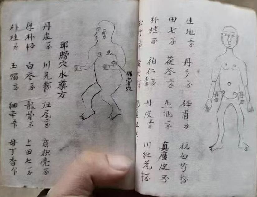 中医跌打古籍《广东彭公点打接骨》(图8)