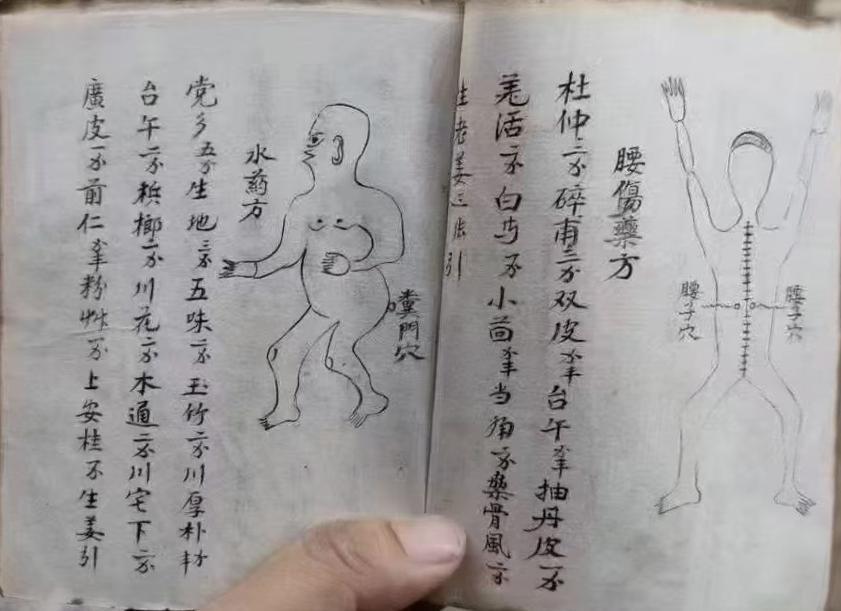 中医跌打古籍《广东彭公点打接骨》(图7)