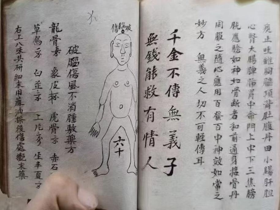 中医跌打古籍《广东彭公点打接骨》(图3)