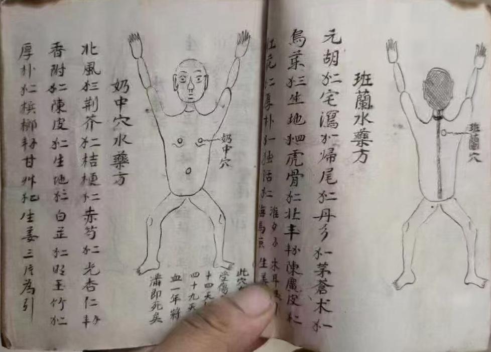 中医跌打古籍《广东彭公点打接骨》(图6)