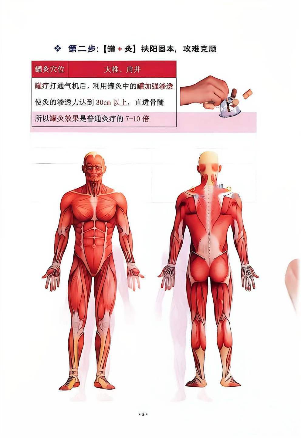 中医书籍《孙思邈罐法讲义》(图5)