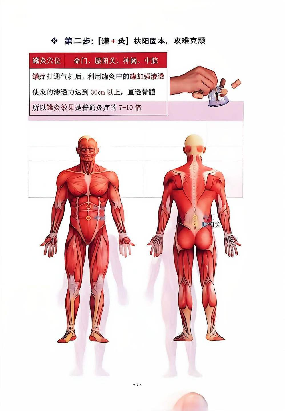 中医书籍《孙思邈罐法讲义》(图9)