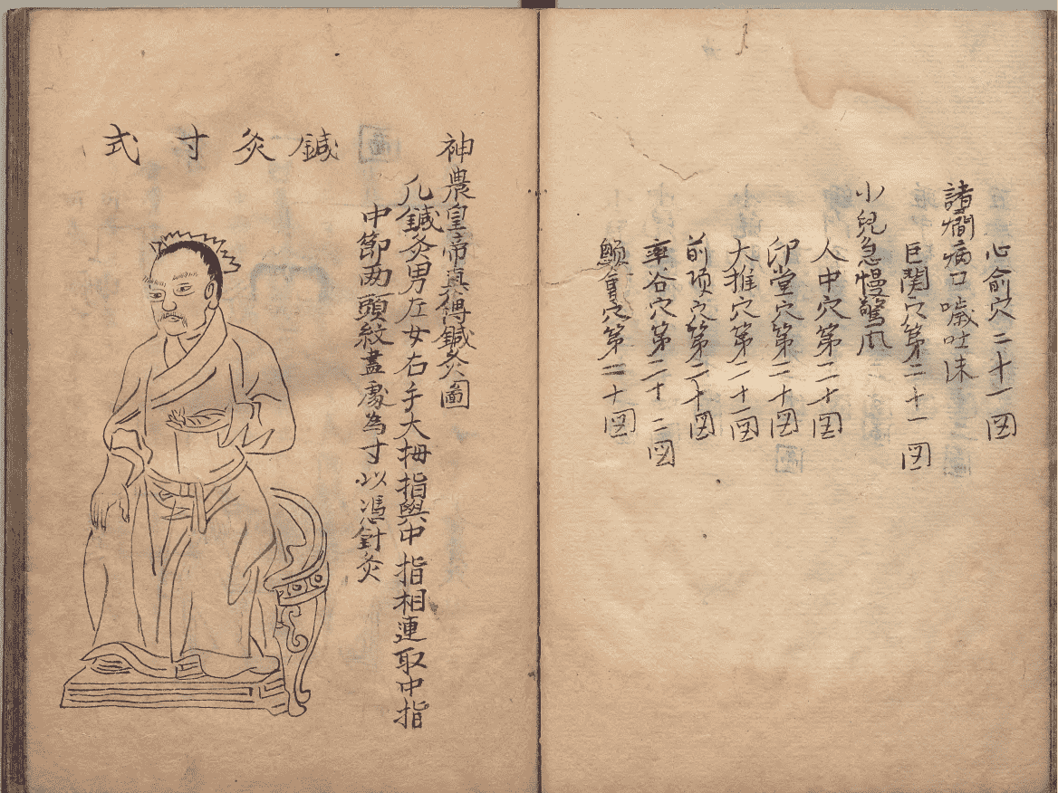 《神农皇帝真传针灸图》(图12)