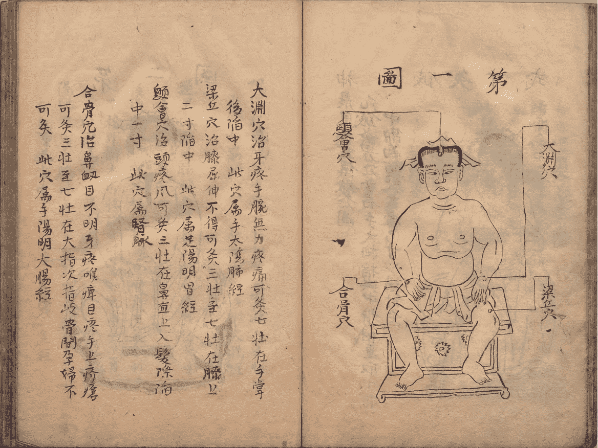 《神农皇帝真传针灸图》(图13)