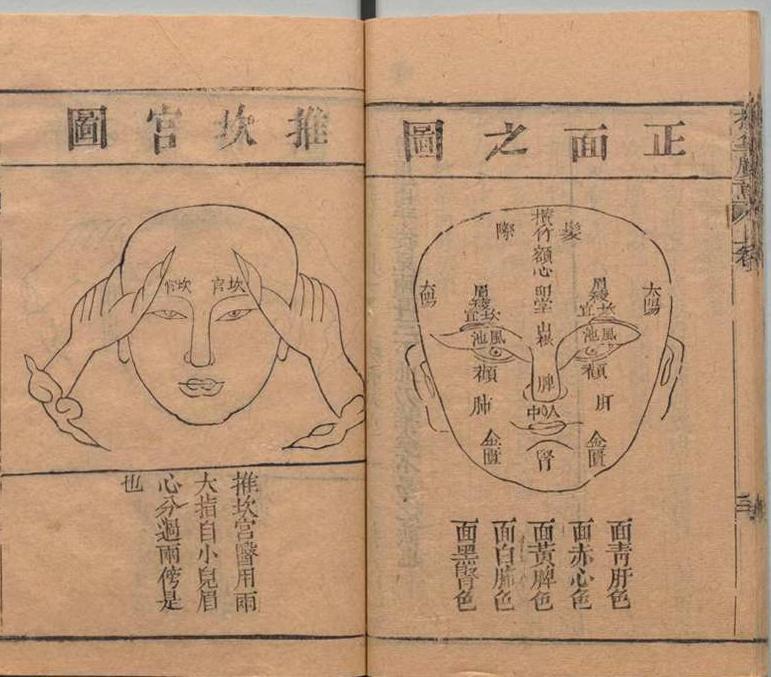 中医古籍 道光本《小儿推拿广意》(图9)