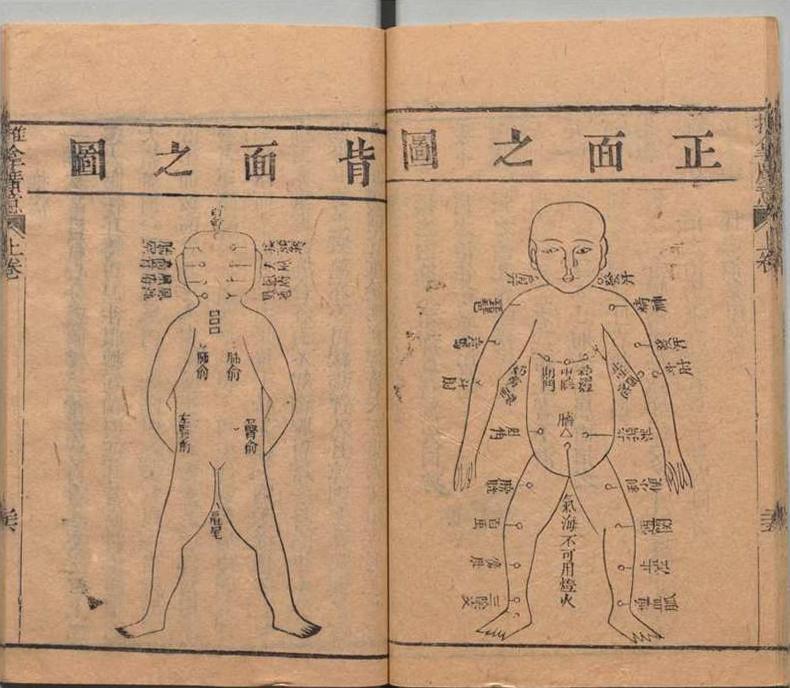 中医古籍 道光本《小儿推拿广意》(图4)