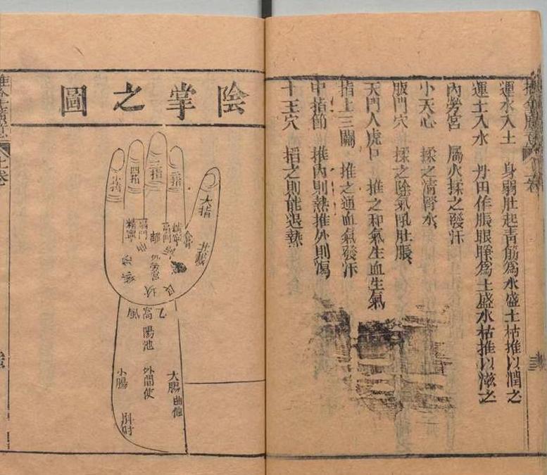 中医古籍 道光本《小儿推拿广意》(图7)