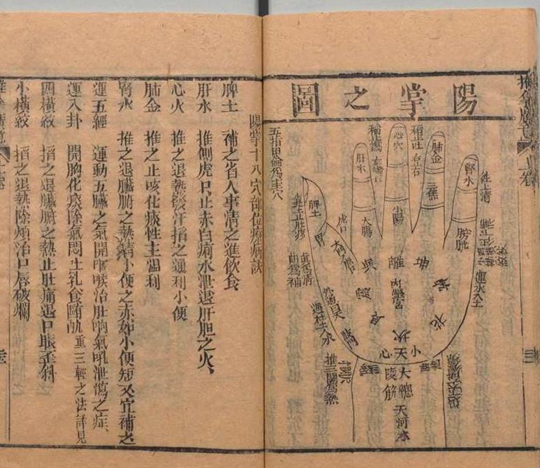 中医古籍 道光本《小儿推拿广意》(图8)