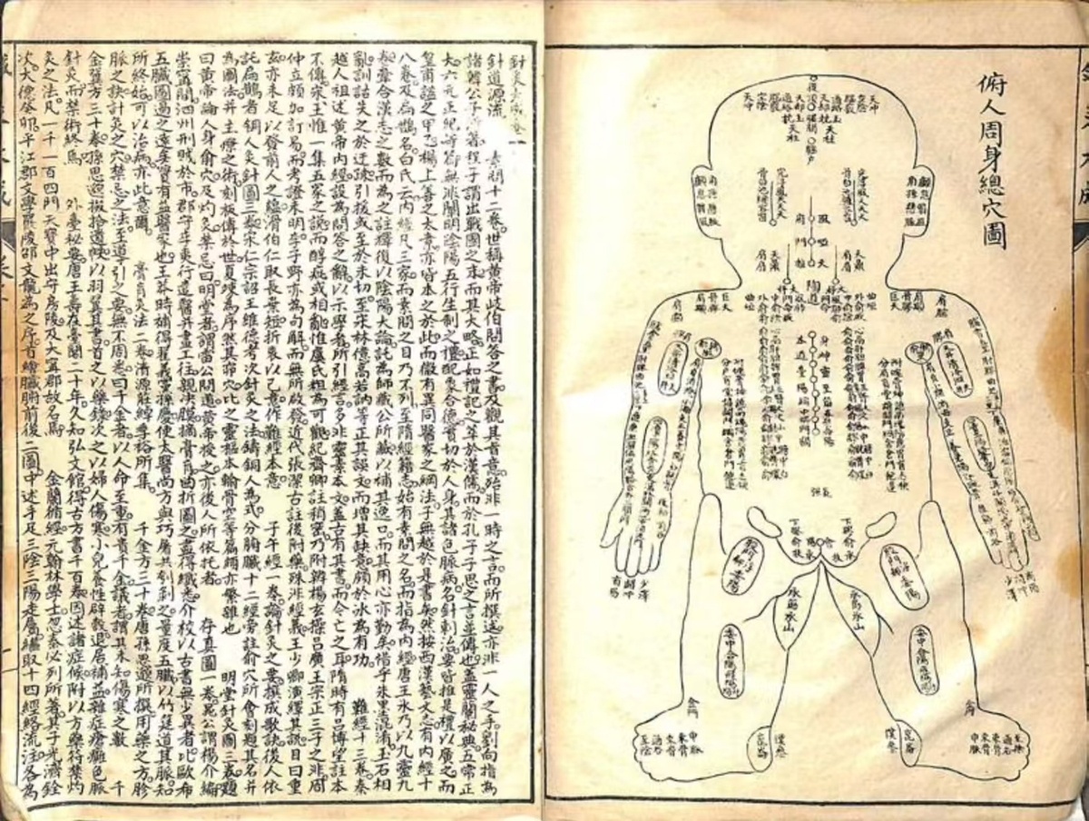 中医针灸古籍《针灸大成》(图4)