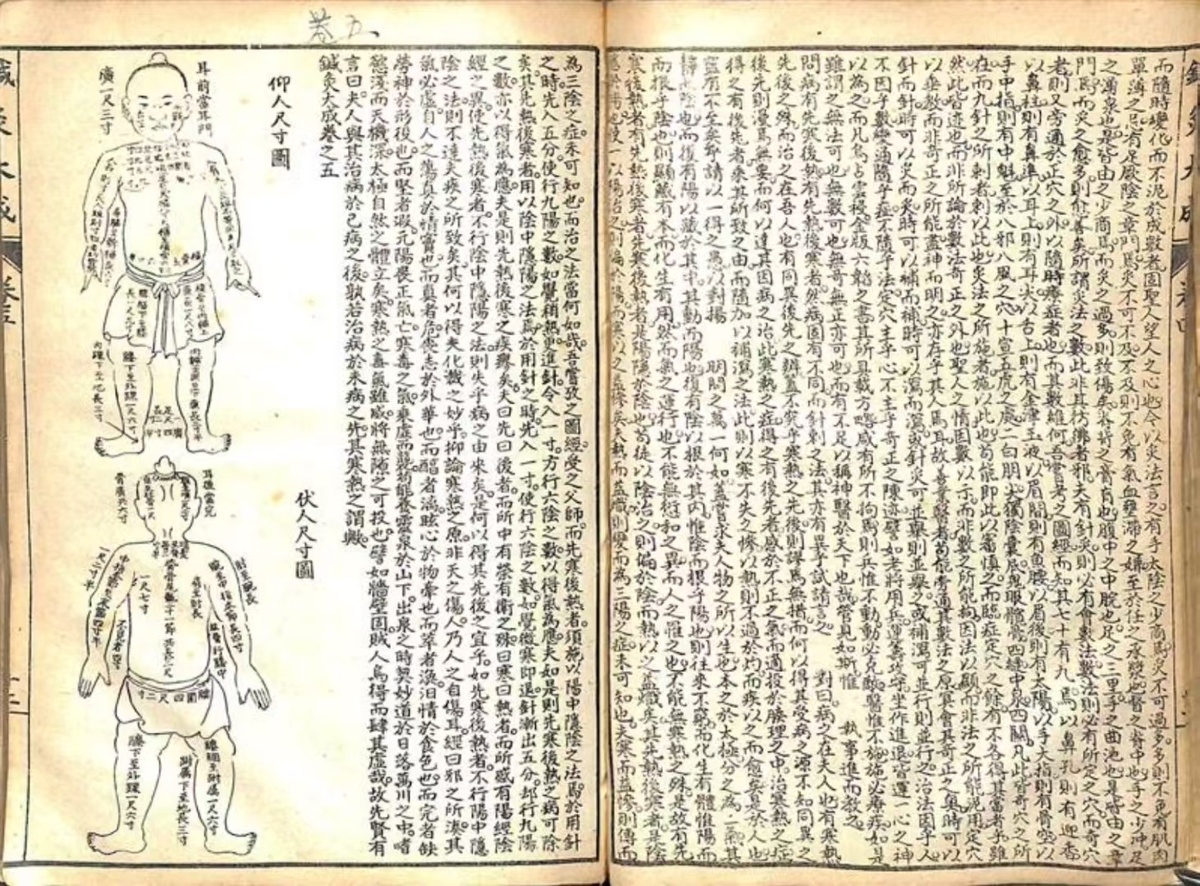 中医针灸古籍《针灸大成》(图5)