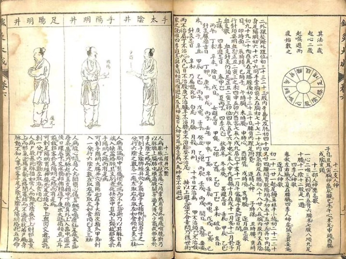 中医针灸古籍《针灸大成》(图9)
