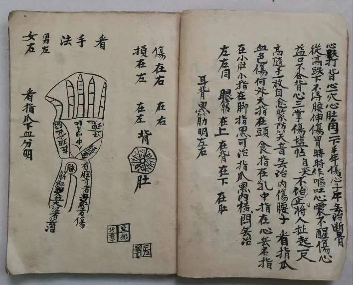 中医跌打古籍《铁打刀伤穴伤秘方总论》(图3)