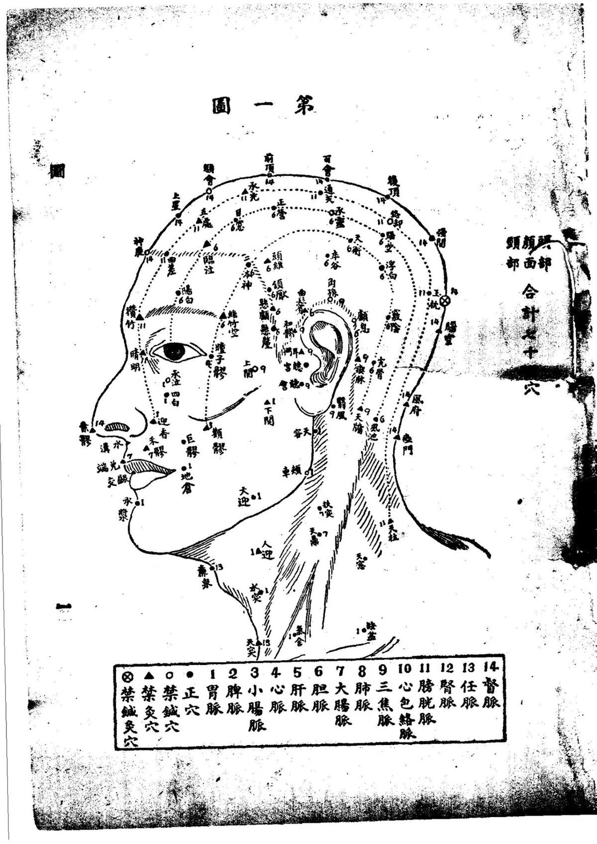 中医针灸书籍《针灸精粹》李文宪(图7)