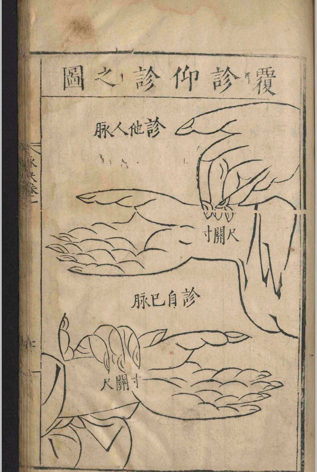 中医古籍《​图注王叔和脉诀》王叔和 张世贤(图16)