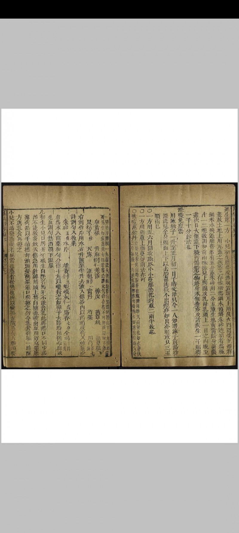 新刊万病回春原本 八卷(图8)