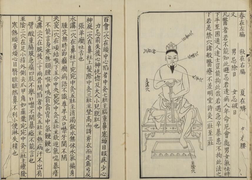 新刊黄帝明堂灸経(图4)