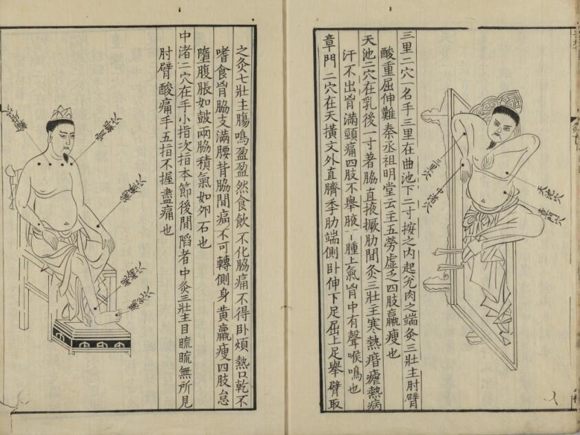 新刊黄帝明堂灸経(图5)