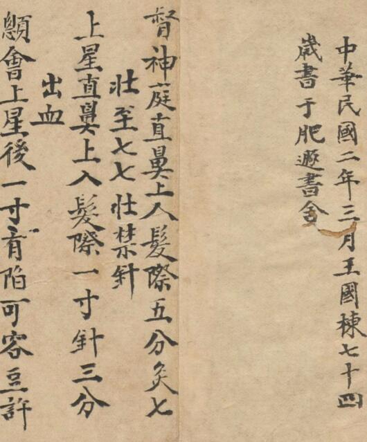 针灸图 中医古籍(图2)
