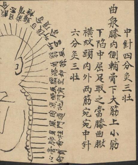 针灸图 中医古籍(图3)