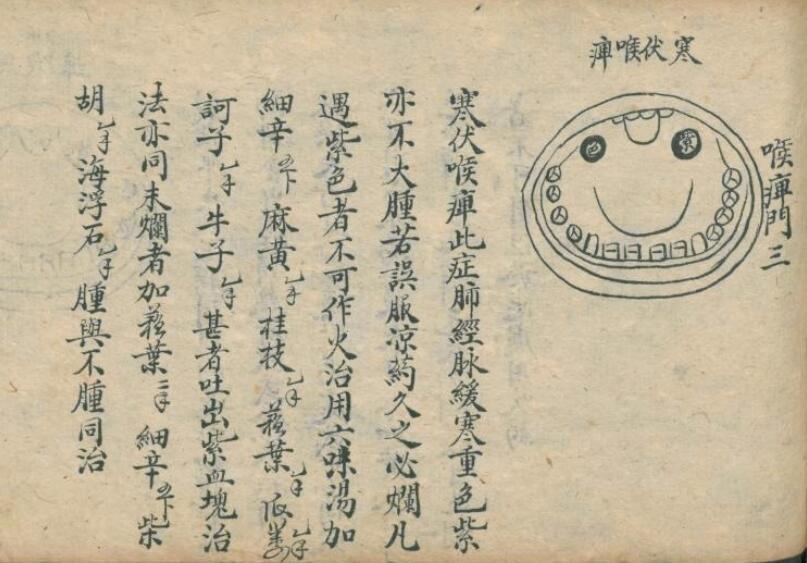 咽喉秘集 中医古籍(图4)