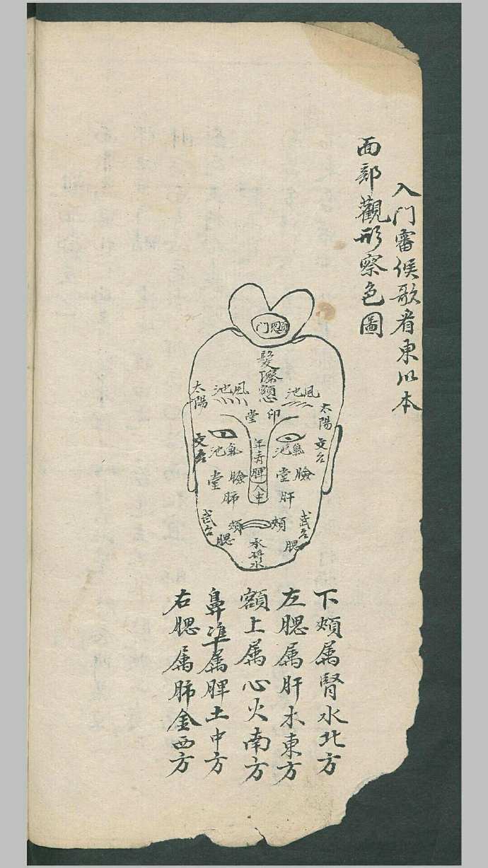 周于藩 宋驰化 丁芳溪 推拿纂正 推拿术祖传(图3)