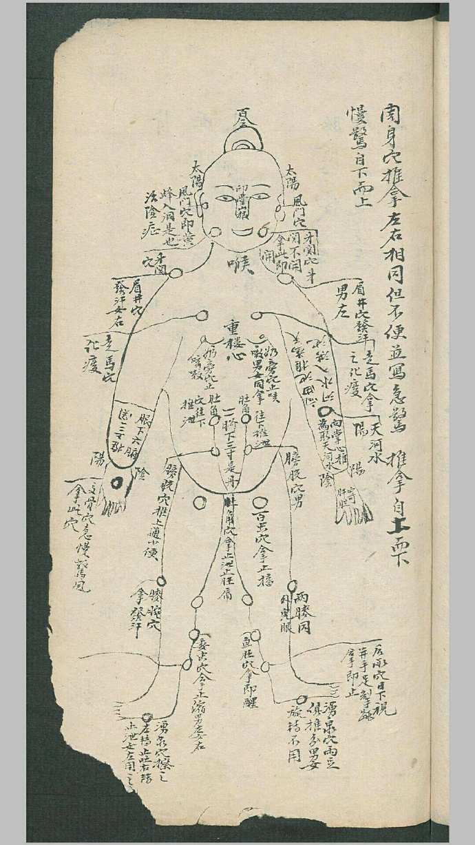 周于藩 宋驰化 丁芳溪 推拿纂正 推拿术祖传(图5)