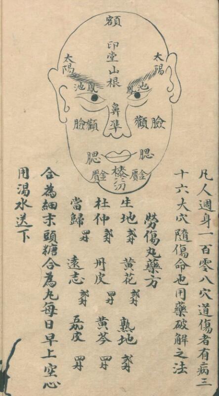 姚仰三; 黃廷 秘傳跌打鈸方(图4)