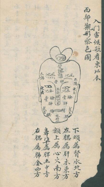 周于藩; 宋馳化; 丁芳溪 推拿纂正(图5)