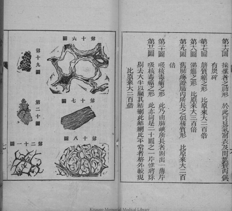 病理撮要(图5)