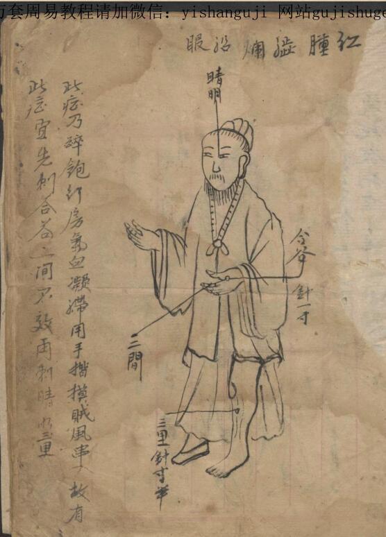 绘图眼科秘方(图2)