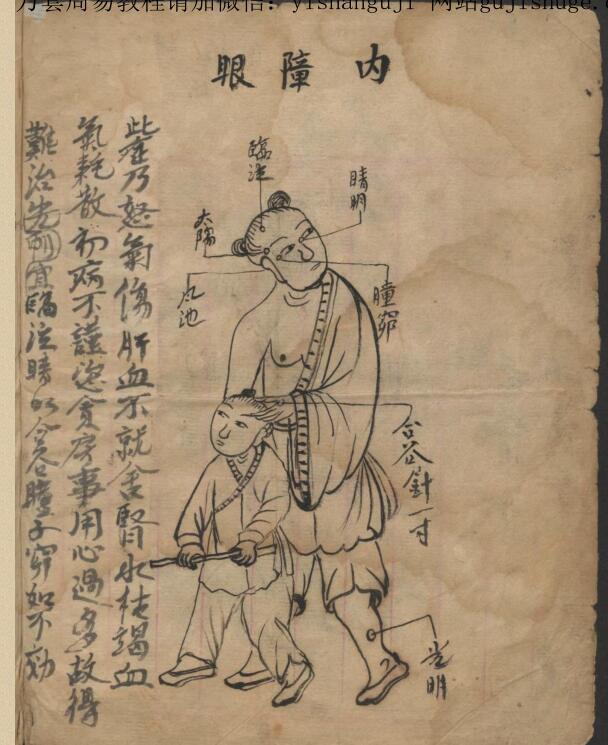 绘图眼科秘方(图3)