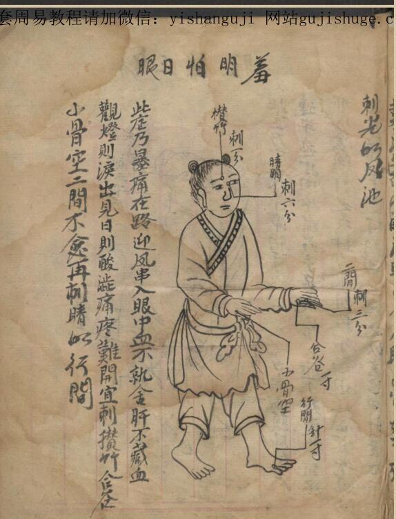 绘图眼科秘方(图4)