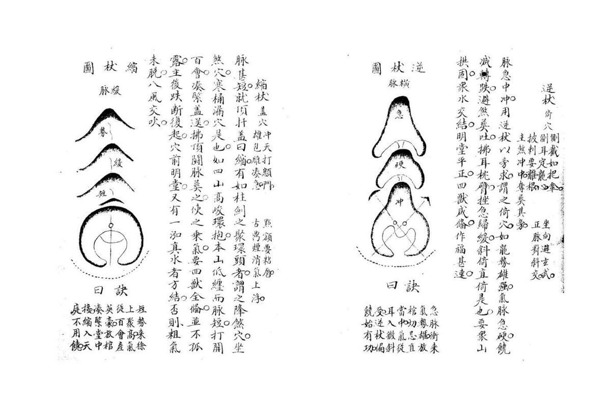 倒杖十二法不分卷 (唐)(图2)