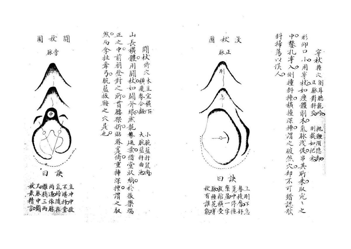 倒杖十二法不分卷 (唐)(图4)