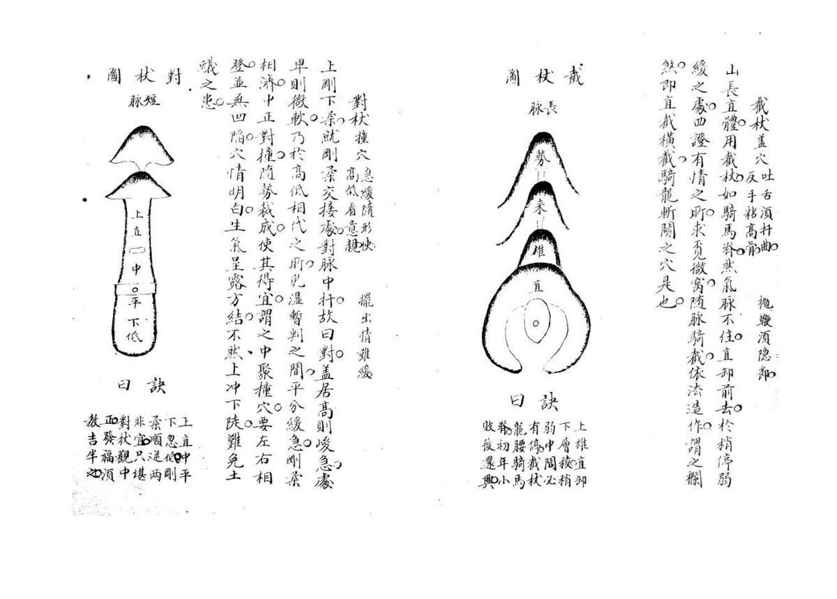 倒杖十二法不分卷 (唐)(图5)